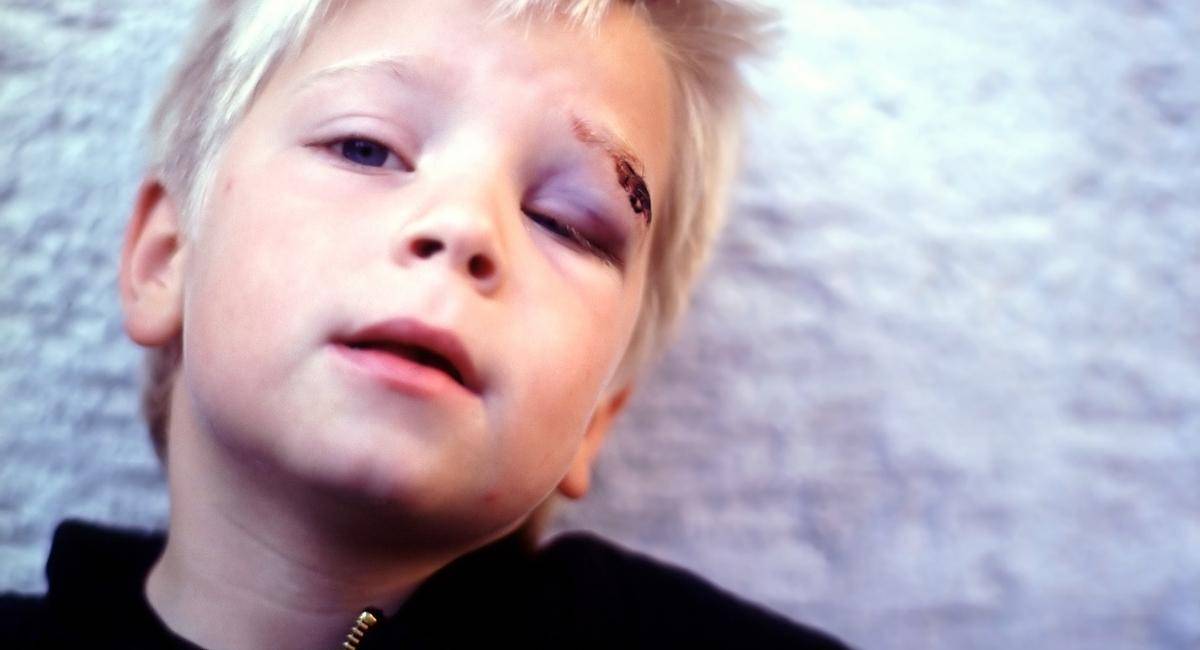 injury to a child - body